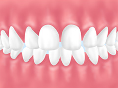 orthodontics03